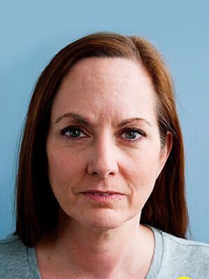 La peau de Joanna avant d'utiliser la crème Eudalie a donné son âge
