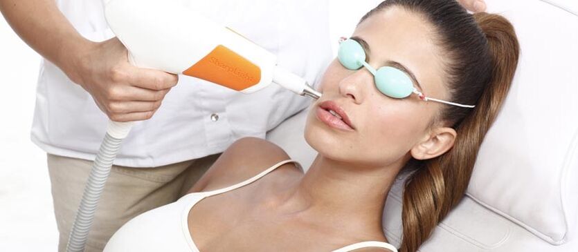 Rajeunissement de la peau au laser