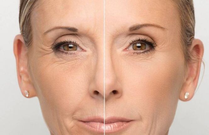 Peau du visage avant et après rajeunissement avec des masques.